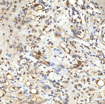 SPTBN2 Rabbit Polyclonal Antibody