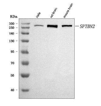 SPTBN2 Rabbit Polyclonal Antibody