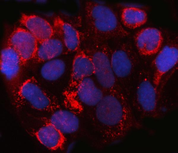 SPACA3 Rabbit Polyclonal Antibody