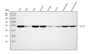 ST13 Rabbit Polyclonal Antibody