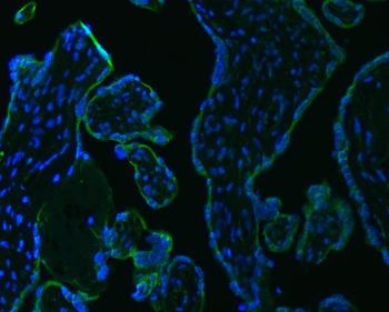 SRPRB Rabbit Polyclonal Antibody