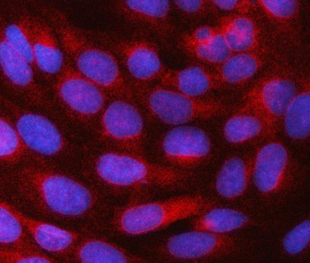 SRPRB Rabbit Polyclonal Antibody