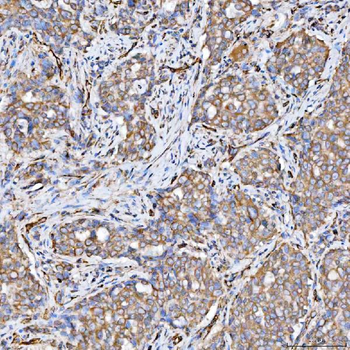 SRPRB Rabbit Polyclonal Antibody