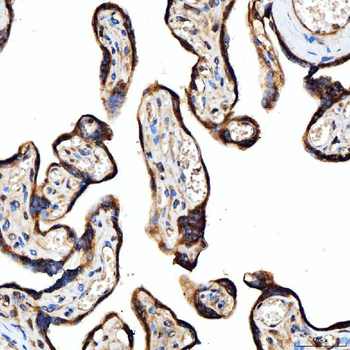 SRPRB Rabbit Polyclonal Antibody