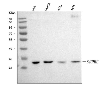 SRPRB Rabbit Polyclonal Antibody
