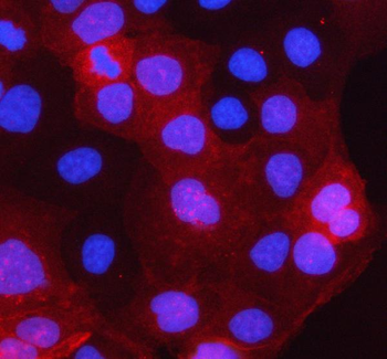 PCTP-L/STARD10/PCTP Rabbit Polyclonal Antibody