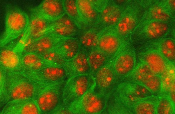 PSE/SPDEF Rabbit Polyclonal Antibody