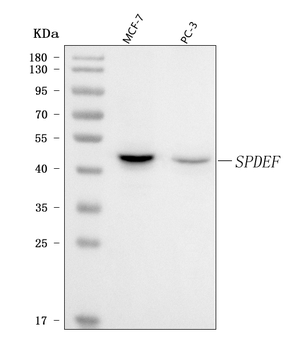 PSE/SPDEF Rabbit Polyclonal Antibody