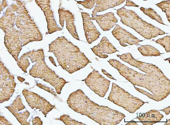Porin/VDAC1 Antibody
