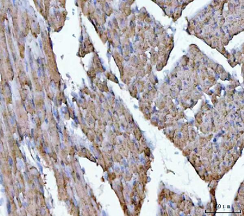 Porin/VDAC1 Antibody
