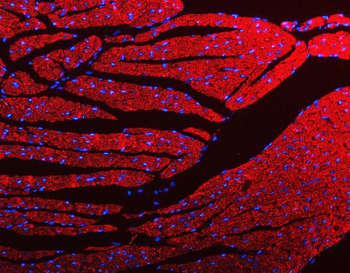 Porin/VDAC1 Antibody