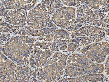 Porin/VDAC1 Antibody