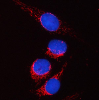 PYCR2 Rabbit Polyclonal Antibody