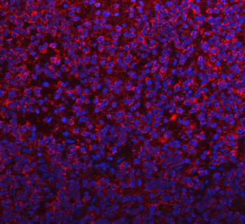 PYCR1 Rabbit Polyclonal Antibody