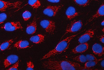 PYCR1 Rabbit Polyclonal Antibody