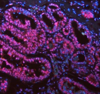 ASC/TMS1/PYCARD Antibody