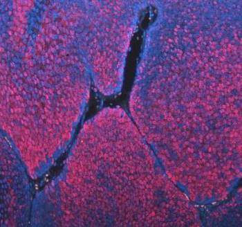 ASC/TMS1/PYCARD Antibody
