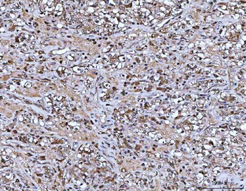 ASC/TMS1/PYCARD Antibody