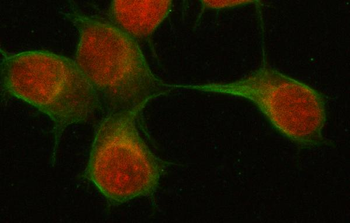 PSMD6 Rabbit Polyclonal Antibody