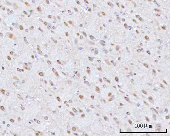 PSMD4 Rabbit Polyclonal Antibody
