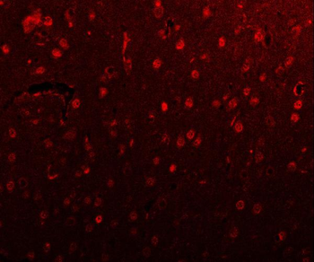 PSMD4 Rabbit Polyclonal Antibody