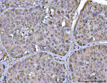 PSMD4 Rabbit Polyclonal Antibody