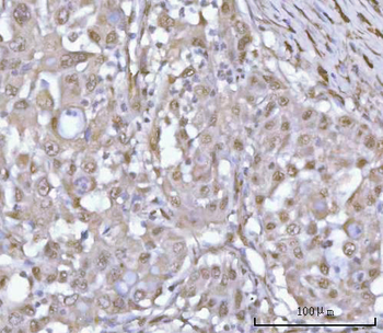 PSMD4 Rabbit Polyclonal Antibody