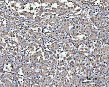 PSMD4 Rabbit Polyclonal Antibody