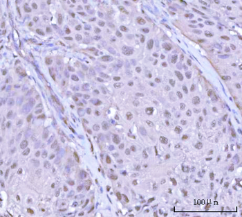 PSMD4 Rabbit Polyclonal Antibody