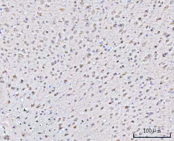PSMD4 Rabbit Polyclonal Antibody