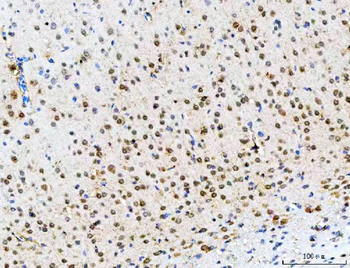 POH1/PSMD14 Rabbit Polyclonal Antibody