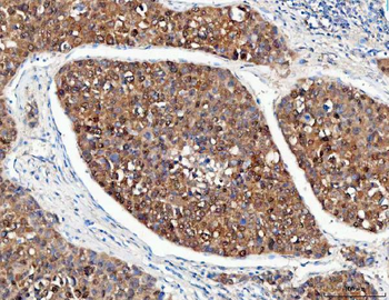 POH1/PSMD14 Rabbit Polyclonal Antibody