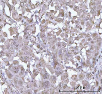 POH1/PSMD14 Rabbit Polyclonal Antibody