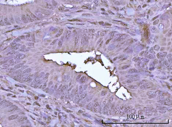 POH1/PSMD14 Rabbit Polyclonal Antibody