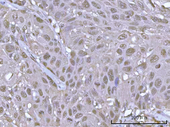 POH1/PSMD14 Rabbit Polyclonal Antibody