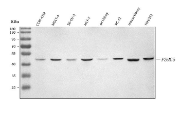 PSMC5 Rabbit Polyclonal Antibody