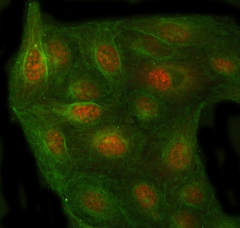 PSMC4 Rabbit Polyclonal Antibody