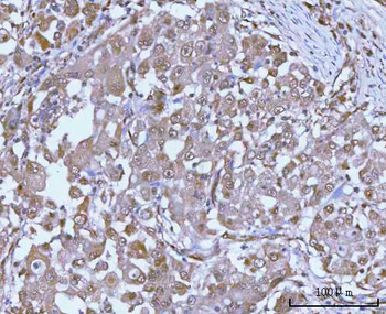 PSMC4 Rabbit Polyclonal Antibody