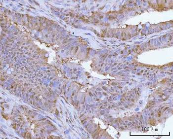 PSMC4 Rabbit Polyclonal Antibody
