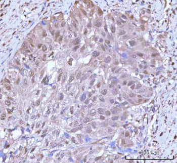 PSMC4 Rabbit Polyclonal Antibody
