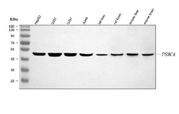 PSMC4 Rabbit Polyclonal Antibody
