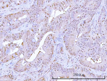 PSMB9 Rabbit Polyclonal Antibody