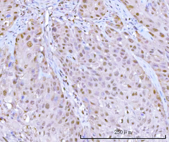 PSMB9 Rabbit Polyclonal Antibody