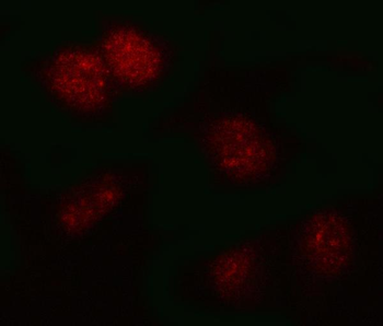 PSMB2 Rabbit Polyclonal Antibody