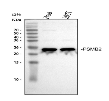PSMB2 Rabbit Polyclonal Antibody