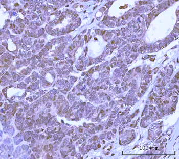 PRPF18 Rabbit Polyclonal Antibody