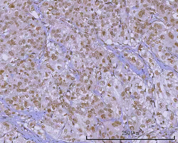 PRPF18 Rabbit Polyclonal Antibody