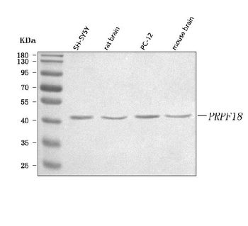 PRPF18 Rabbit Polyclonal Antibody