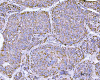 NDUFAF4 Rabbit Polyclonal Antibody