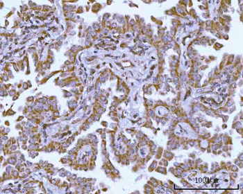 NDUFAF4 Rabbit Polyclonal Antibody